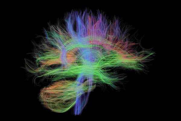 Neuro-image of the brain. 